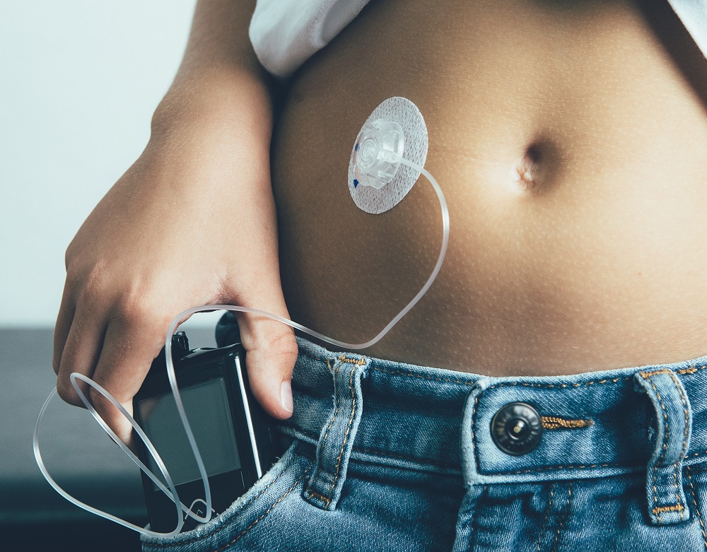 Medtronic shares study results on extended wear infusion set from American Diabetes Association Conference