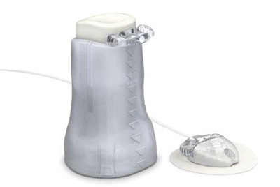 Medtronic introduces MiniMed Mio Advance Infusion Set enabling fewer insertion steps for people with diabetes in the U.S.