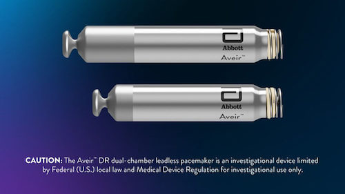 Abbott Announces World’s First Implant Of Dual-chamber Leadless Pacemaker